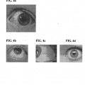 Ilustración 4 de Composiciones y métodos para el blanqueamiento del ojo