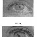 Ilustración 11 de Composiciones y métodos para el blanqueamiento del ojo