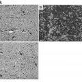 Ilustración 8 de Mimotopos de alfa-sinucleína y vacunas de los mismos para el tratamiento de los trastornos neurodegenerativos