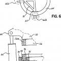 Ilustración 6 de Aparato y método de retirada de rodamiento de pala de turbina eólica
