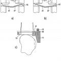 Ilustración 7 de Instrumental para la inserción de una prótesis articulada, en particular prótesis de rodilla