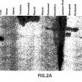 Ilustración 2 de Métodos, anticuerpos y kits para la detección de líquido cefalorraquídeo en una muestra