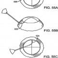 Ilustración 10 de Dispositivo para el tratamiento de glaucoma