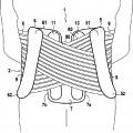 Ilustración 3 de Dispositivo de sostén, concretamente lumbar.