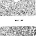 Ilustración 15 de Anticuerpos anti-IL-6, compuestos métodos y usos