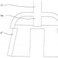 Ilustración 9 de Prótesis de cadena osicular con elemento de fijación almohadillado