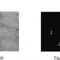 Ilustración 4 de Sistema y método de detección de parásitos Anisakis en filetes de pescado