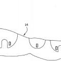 Ilustración 3 de Monitorización del cumplimiento mediante el uso de la detección del llenado de nuevo de las venas