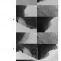 Ilustración 10 de Nuevo biomaterial procedente de gelatina de Wharton de cordón umbilical
