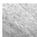 Ilustración 11 de Nuevo biomaterial procedente de gelatina de Wharton de cordón umbilical