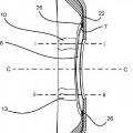 Ilustración 2 de Control de la flexión de una placa para la piel para usar en un aparato de ostomía.