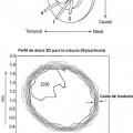 Ilustración 23 de Radiocirugía ocular