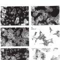 Ilustración 26 de Diferenciación de células no productoras de insulina en células productoras de insulina mediante GLP-1 o exendina-4 y utilizaciones de las mismas