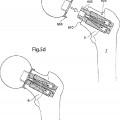 Ilustración 9 de Dispositivo de articulación de cadera