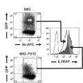 Ilustración 1 de Expresión de IL1RAP en células de leucemia mieloide aguda y crónica.
