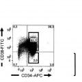 Ilustración 2 de Expresión de IL1RAP en células de leucemia mieloide aguda y crónica