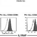 Ilustración 12 de Expresión de IL1RAP en células de leucemia mieloide aguda y crónica