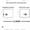 Ilustración 15 de Expresión de IL1RAP en células de leucemia mieloide aguda y crónica