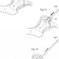Ilustración 8 de Dispositivo de articulación de cadera