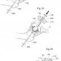 Ilustración 16 de Dispositivo de articulación de cadera