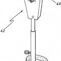Ilustración 6 de Aparato para uso en artroplastia en una articulación de rodilla
