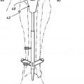 Ilustración 7 de Aparato para uso en artroplastia en una articulación de rodilla