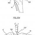 Ilustración 21 de Aparato para uso en artroplastia en una articulación de rodilla