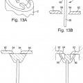 Ilustración 12 de Dispositivo de inyección de un implante sólido o semisólido
