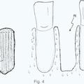Ilustración 3 de Sistema de implante.