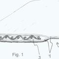 Ilustración 4 de Sistema de implante.