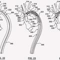 Ilustración 3 de El acoplamiento externo móvil para conexión de rama vascular