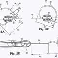 Ilustración 1 de Diseño de aguja para sling transobturador masculino.