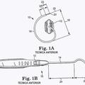 Ilustración 4 de Diseño de aguja para sling transobturador masculino