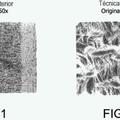 Ilustración 4 de Superficies biocompatibles perfeccionadas y dispositivos que incorporan tales superficies