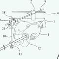 Ilustración 2 de Dispositivo para el posicionamiento de la copa acetabular y método para ello.