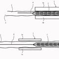 Ilustración 1 de Disposición y procedimiento para preparar una endoprótesis para implantación con una envuelta.