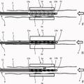 Ilustración 2 de Disposición y procedimiento para preparar una endoprótesis para implantación con una envuelta.