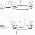 Ilustración 3 de Disposición y procedimiento para preparar una endoprótesis para implantación con una envuelta.