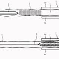 Ilustración 4 de Disposición y procedimiento para preparar una endoprótesis para implantación con una envuelta.
