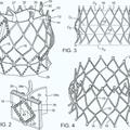 Ilustración 4 de Aparato de suministro de válvula cardiaca protésica que presenta un mecanismo de embrague