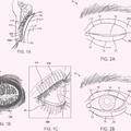 Ilustración 4 de Sistemas de tratamiento de ojo seco.