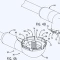 Ilustración 3 de Sistema y método de protección contra rayos para palas de turbina eólica.