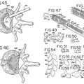 Ilustración 3 de Dispositivos para tratar la columna vertebral.