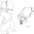 Ilustración 2 de Sistema de interfaz facial y dispositivo de cabeza para su uso con sistemas de ventilación y presión positiva de aire