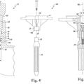 Ilustración 1 de Instrumentos para su uso en el desmontaje de implantes