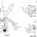 Ilustración 2 de Conjunto válvula de cierre de prótesis de pene implantable