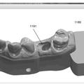 Ilustración 3 de Método de modificación de la parte gingival de un modelo virtual de una dentadura