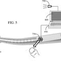 Ilustración 3 de Disposiciones de guiado interactivo y detección de manipulación para un sistema robótico quirúrgico.
